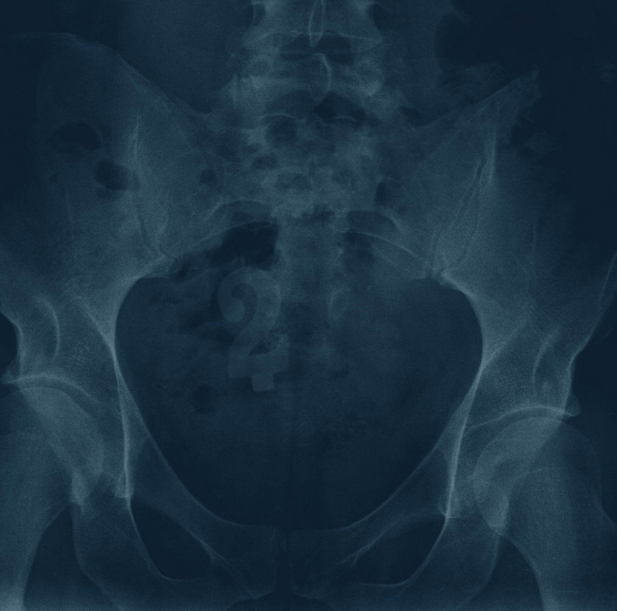 ANTIPODEAN ANOMOLIES 2